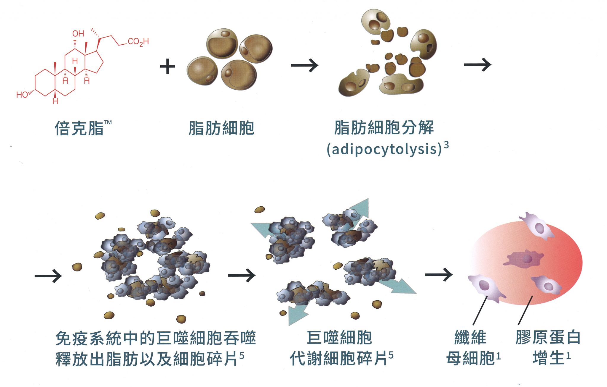 倍克脂Belkyra_悠美診所