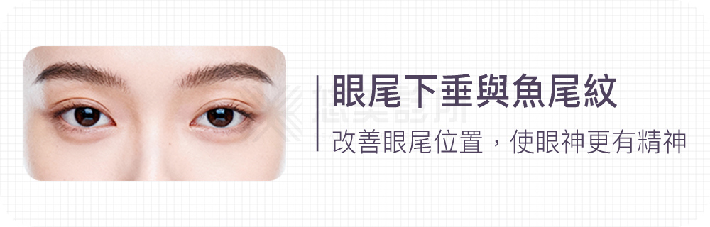 顳側拉皮手術悠美診所
