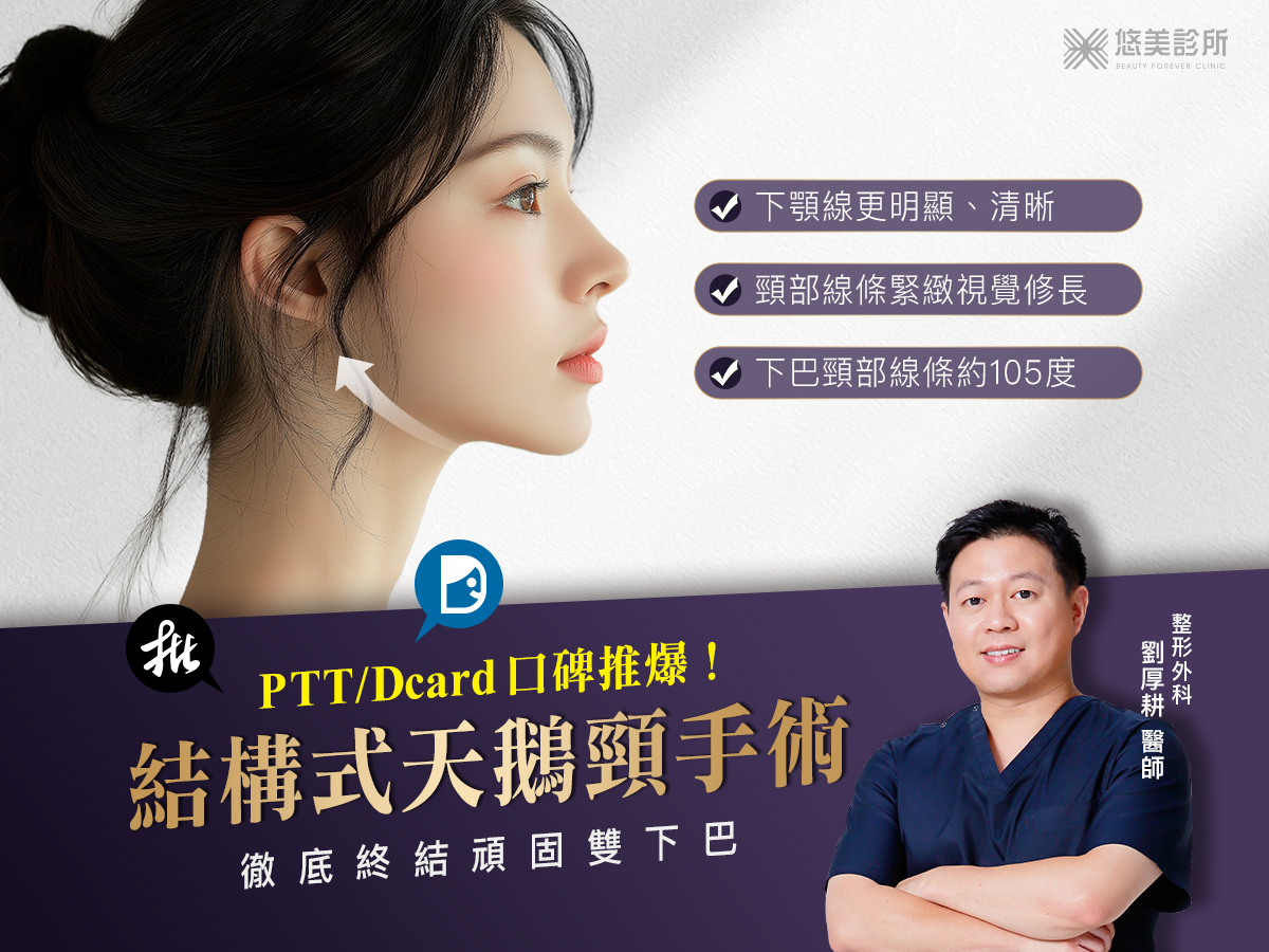 結構式天鵝頸手術_悠美診所