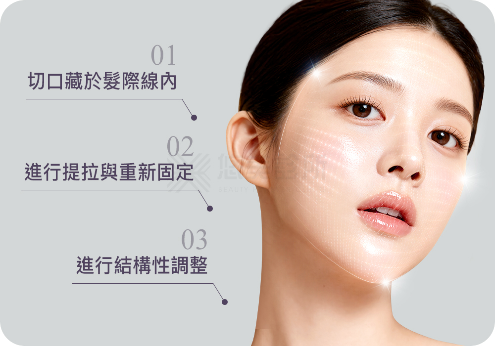 顳側拉皮手術_悠美診所