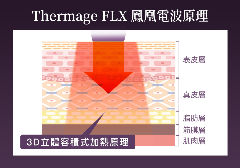 Thermage FLX鳳凰電波