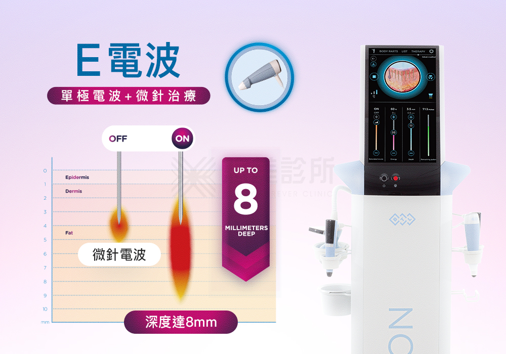 EXION艾可塑電波_悠美診所