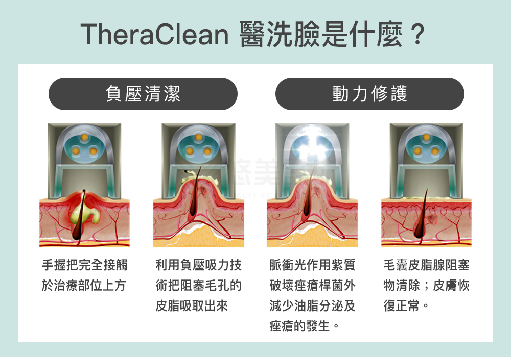 醫洗臉_悠美診所