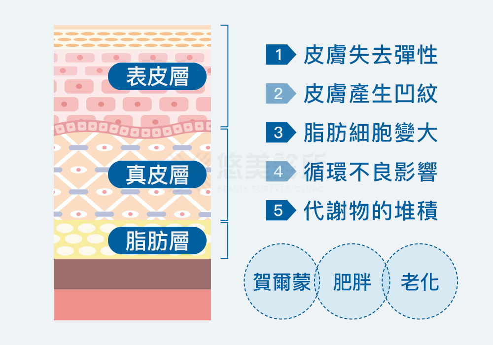 EMTONE擊脂槍_悠美診所