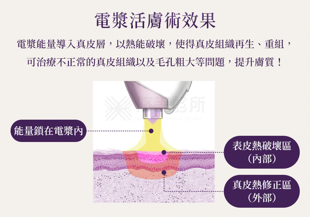 電漿活膚術_悠美診所