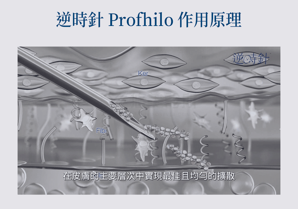 Profhilo逆時針悠美診所