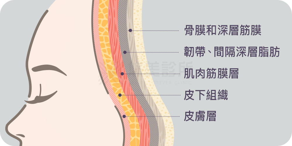 顳側拉皮手術_悠美診所