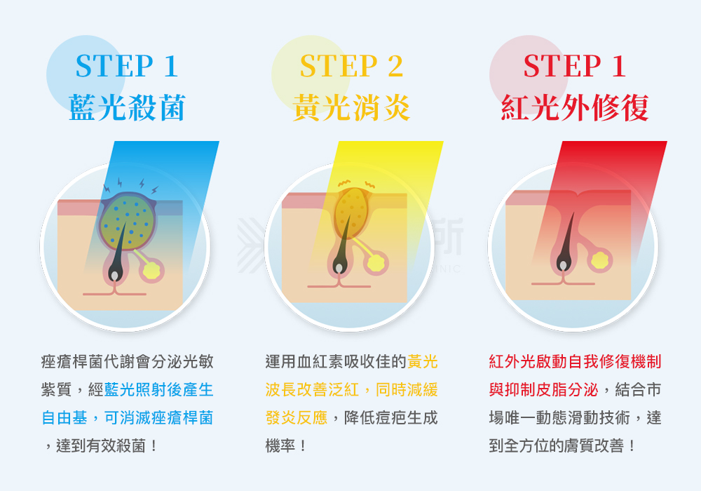 恆淨抗痘BBL_悠美診所