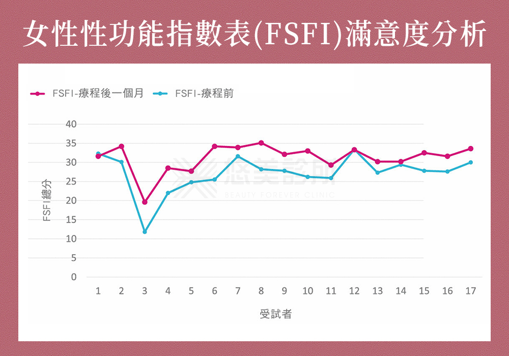 愛麗絲電波（俗稱超快感）_悠美診所