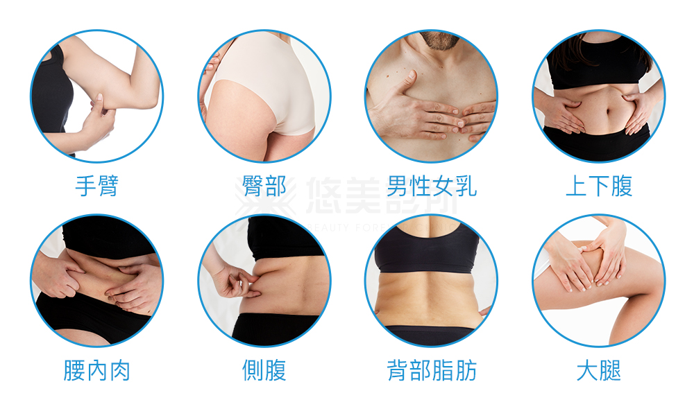 密塑冷凍減脂Micool_悠美診所