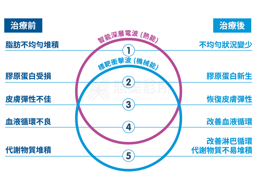 EMTONE擊脂槍_悠美診所