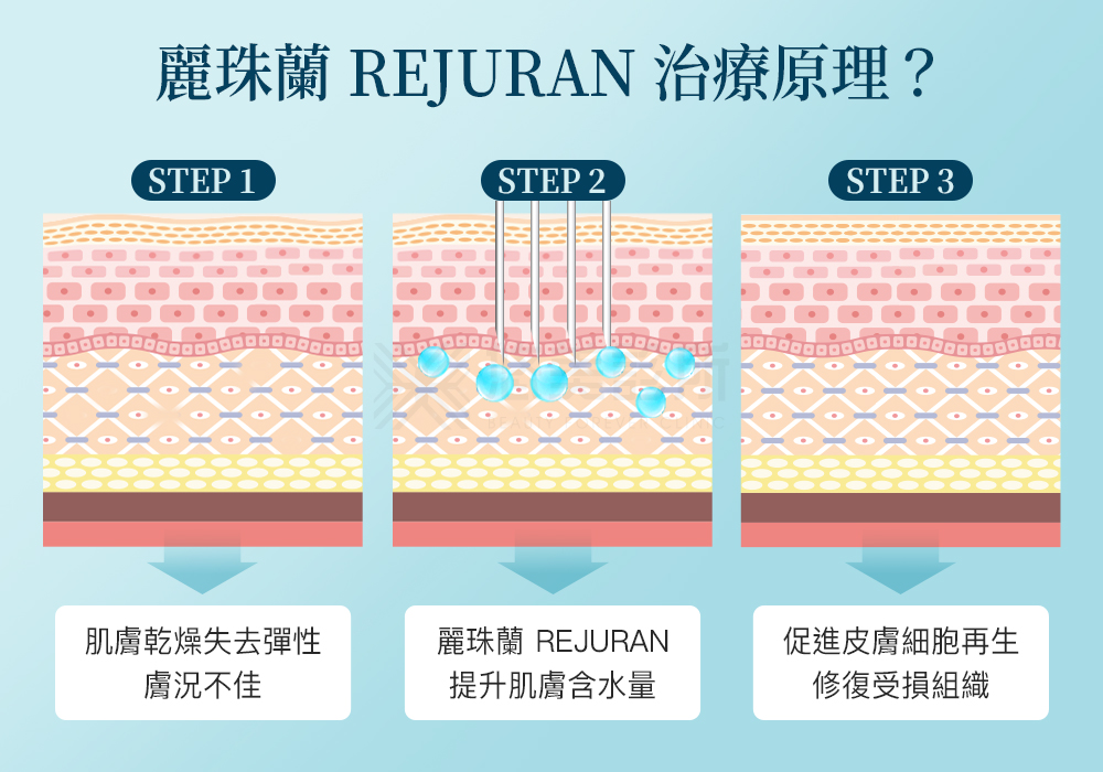 麗珠蘭REJURAN_悠美診所