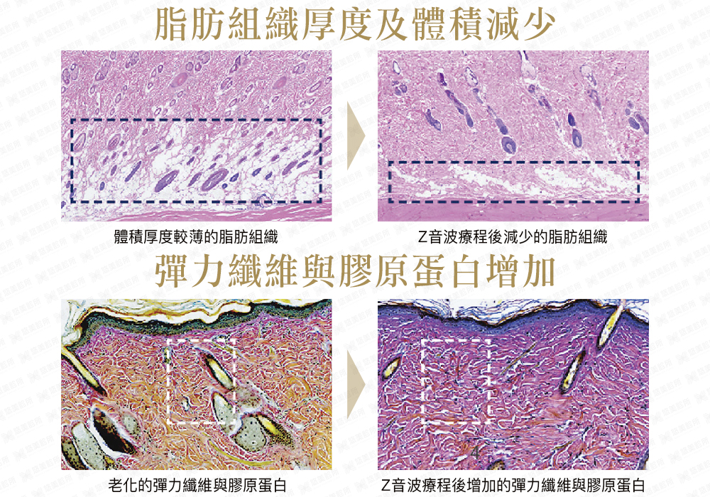 Linear Z音波_悠美診所