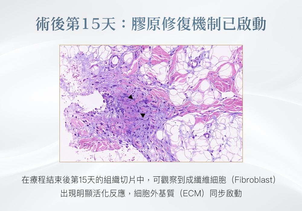 Cellinew犀利電波_悠美診所