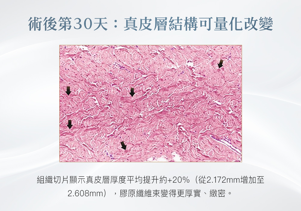 Cellinew犀利電波_悠美診所 Cellinew犀利電波_悠美診所