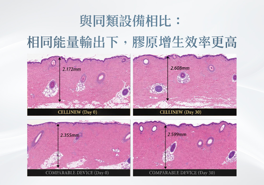 Cellinew犀利電波_悠美診所 Cellinew犀利電波_悠美診所