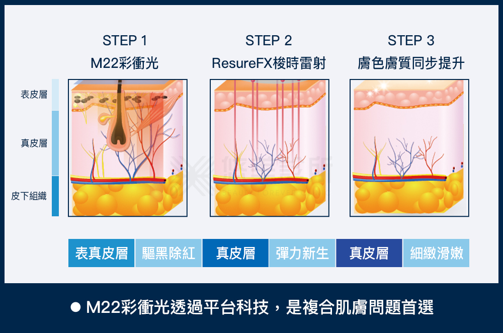 M22彩衝光_悠美診所