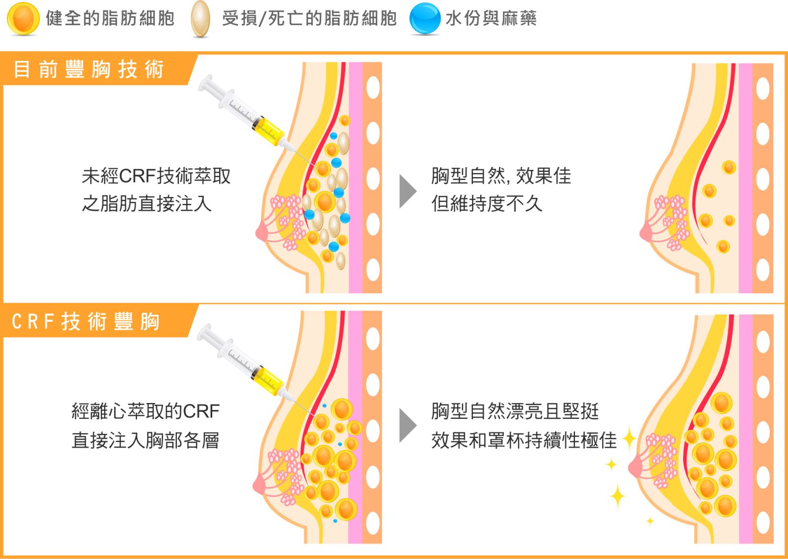 改版升級一切由我 波滔胸湧正是時候！朱芃年醫師